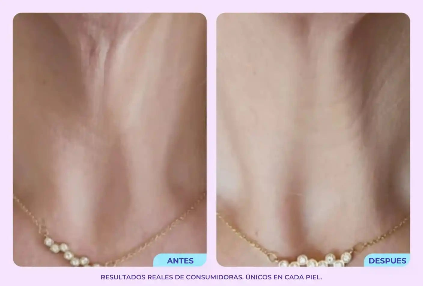 GoPure - Reafirma y transforma tu cuello.