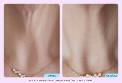 GoPure - Reafirma y transforma tu cuello.