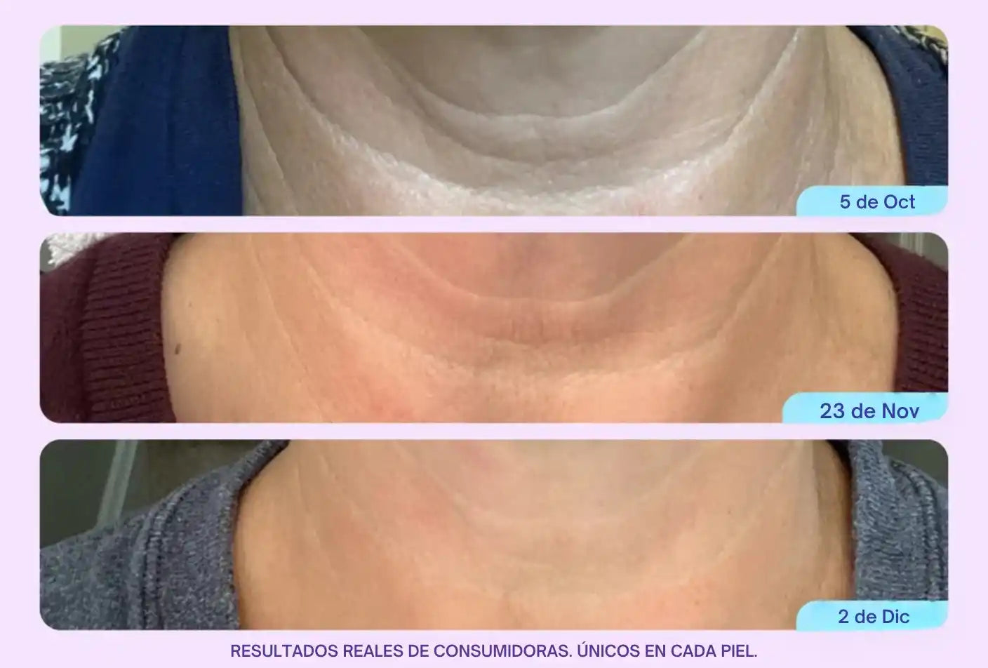 GoPure - Reafirma y transforma tu cuello.