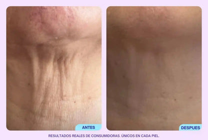 GoPure - Reafirma y transforma tu cuello.